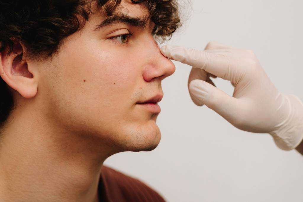 rinoplastica-estetica